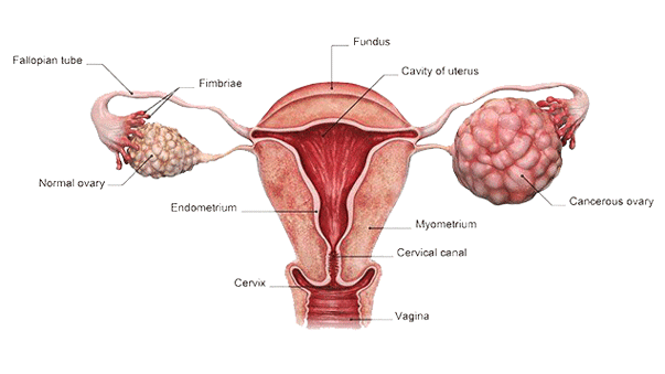 Ovarian Cancer (Stromal, Germ Cell and Krukenberg's Tumour)